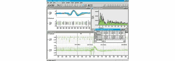 Datenerfassung und -Analyse: CED Spike-2