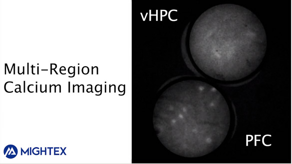 Multi-Region Calcium Imaging Video